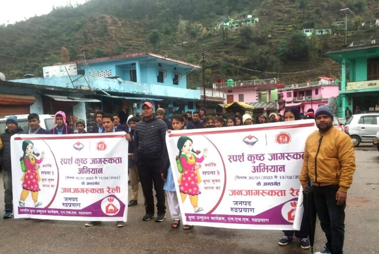 मुख्य चिकित्सा अधिकारी डा0 एस0सी0एस0 मर्तोलिया ने बताया कि राष्ट्रीय स्वास्थ्य मिशन के तहत राष्ट्रीय कुष्ठ उन्मूलन कार्यक्रम के अंतर्गत 30 जनवरी से 13 फरवरी तक स्पर्श कुष्ठ जागरूकता अभियान चलाया जा रहा है।